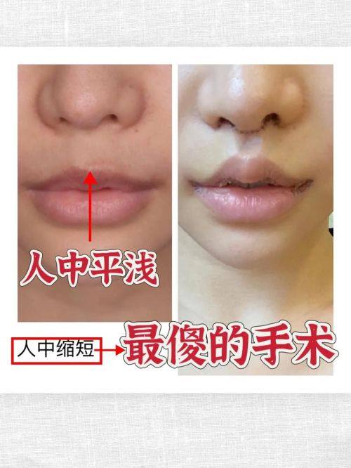 韩国清潭ZN整形外科特色项目及技术优势