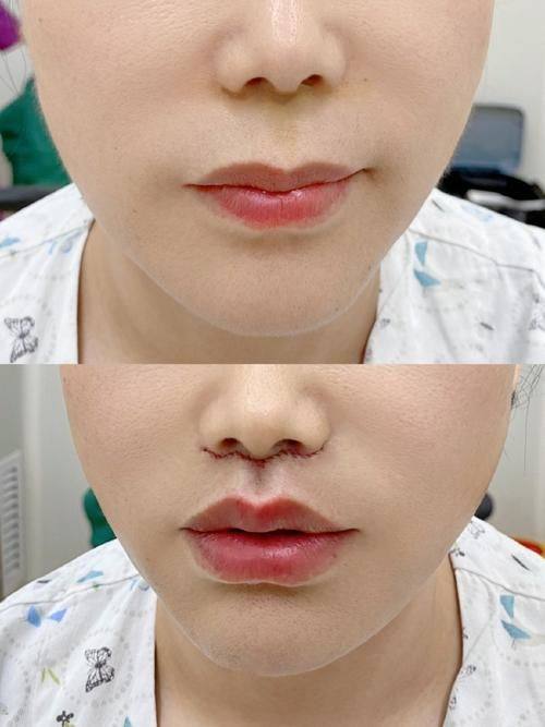 韩国清潭ZN整形外科是正规医院吗？