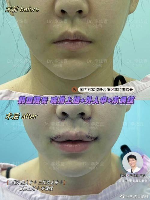 韩国清潭ZN整形外科收费价格表/收费标准