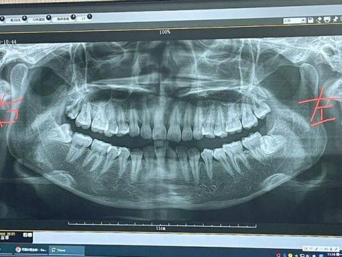 诸城至上口腔收费价格表/收费标准
