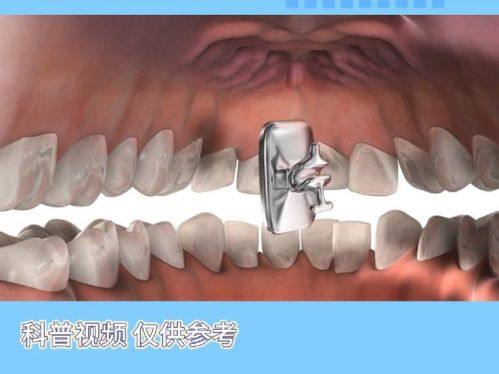 湖南益阳高新博悦口腔详细的预约挂号方式及流程