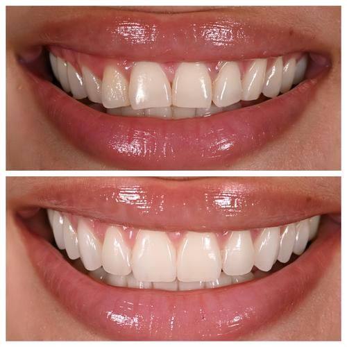 成都爱嘉雅口腔是正规医院吗？