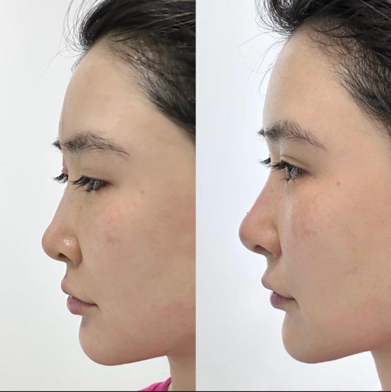 邵阳幻都荣恩整形医院真人口碑评价怎么样?