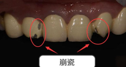 海南海口嘉宇口腔真人口碑评价怎么样？