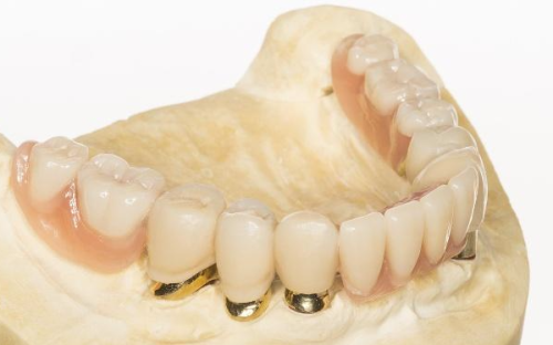 海南海口嘉宇口腔收费价格表/收费标准