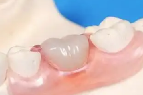 三亚爱雅仕口腔门诊部特色项目及技术优势