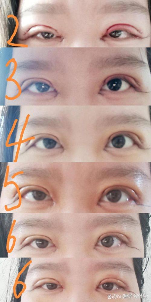 柳州檀悦双美医疗美容诊所真人口碑评价怎么样？