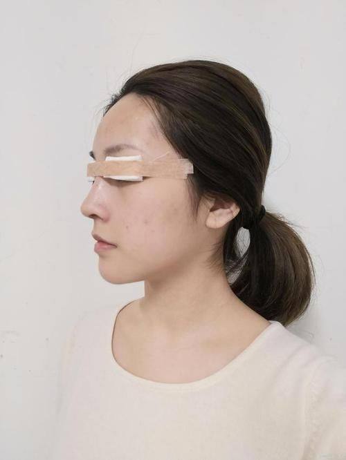 广州南方医 科 大学南方医院整形美容外科真人口碑评价怎么样？