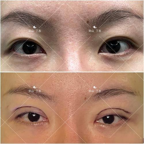 柳州檀悦双美医疗美容诊所特色项目及技术优势