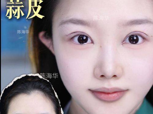 福州恩喜医疗美容门诊部真人口碑评价怎么样？