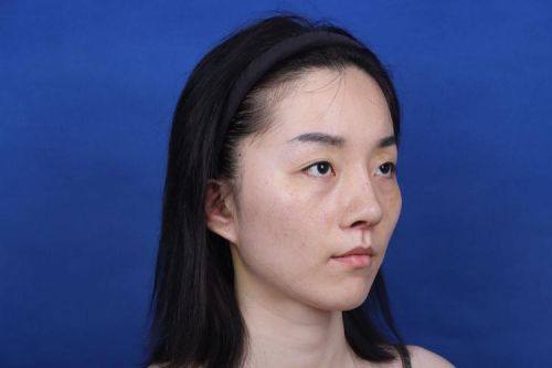 福州恩喜医疗美容门诊部是正规医院吗？