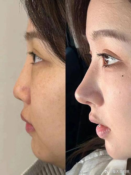 株洲雅美医疗美容门诊部特色项目及技术优势