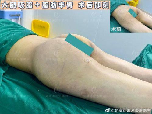 福州恩喜医疗美容门诊部地址电话营业时间