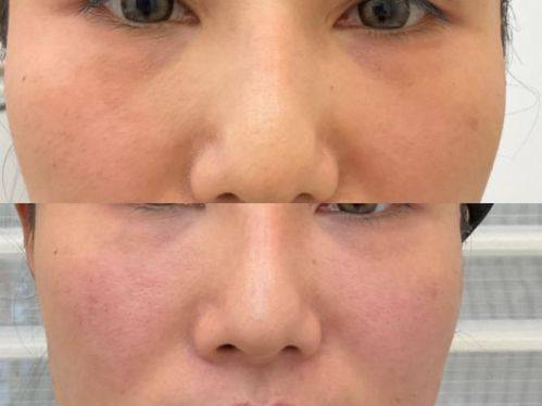 柳州艾尚美整形特色项目及技术优势