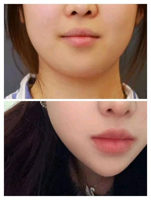 釜山赫拉医院是正规医院吗?