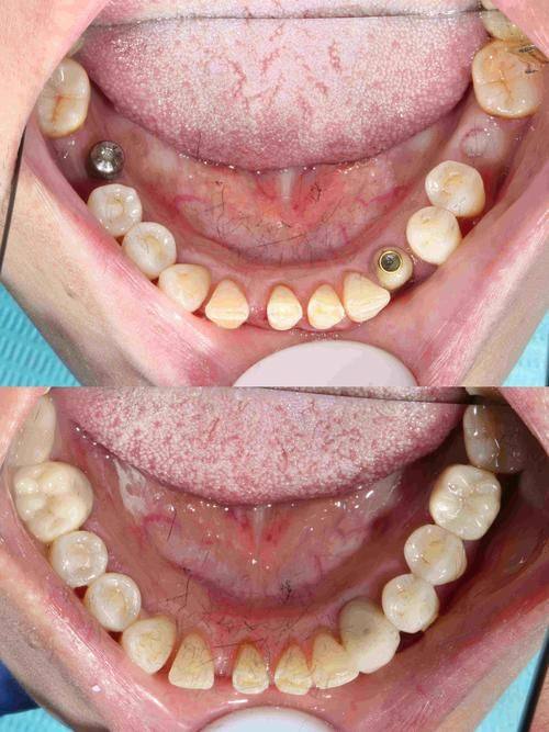 东莞全可口腔门诊部(大朗远大店)真人口碑评价怎么样?