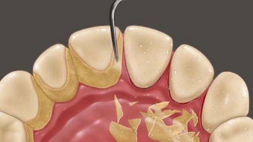 三亚爱雅仕口腔门诊部地址电话营业时间