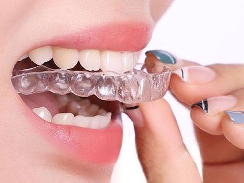 东莞全可口腔门诊部(大朗远大店)收费价格表/收费标准