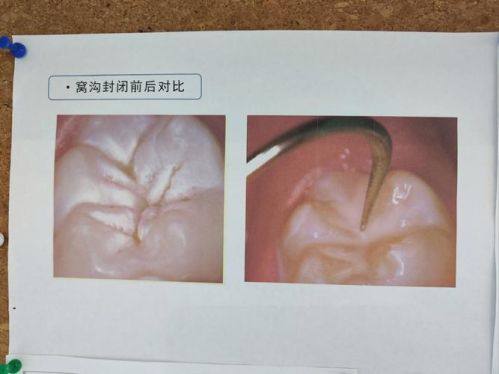 天水市第一人民医院口腔科医生团队实力强大及骨干医生简介