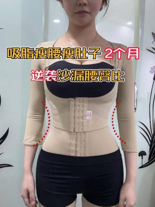 柳州艾尚美整形详细的预约挂号方式及流程