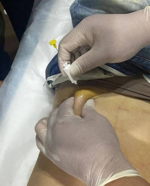 惠州名博医疗美容门诊部是正规医院吗?