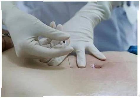 釜山赫拉医院详细的预约挂号方式及流程