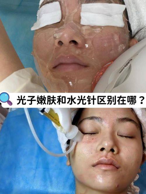 甘肃酒泉华美医疗美容医院特色项目及技术优势