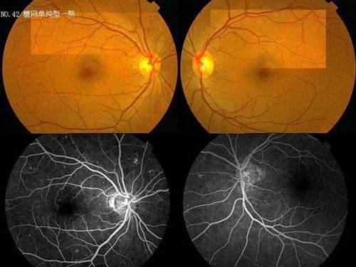 鞍山市中 心医院眼科真人口碑评价怎么样?