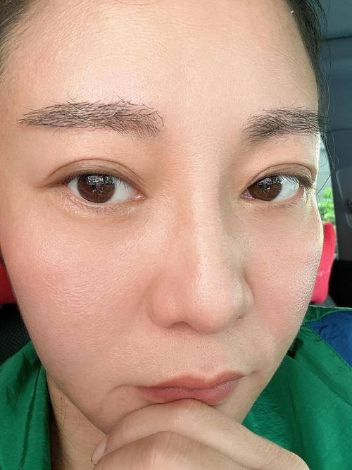 佛山南海观自在整形医院真人口碑评价怎么样?