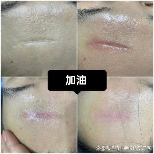 长春碧宝医疗美容门诊部是正规医院吗?