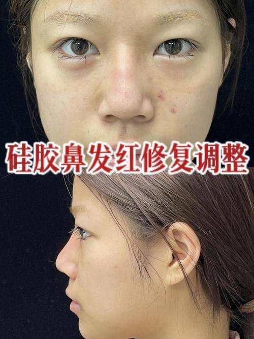 佛山南海观自在整形医院详细的预约挂号方式及流程