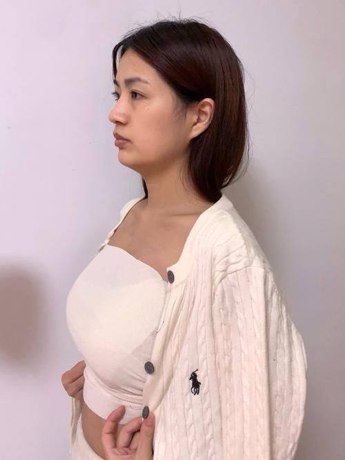 海南依琳医疗美容门诊部收费价格表/收费标准