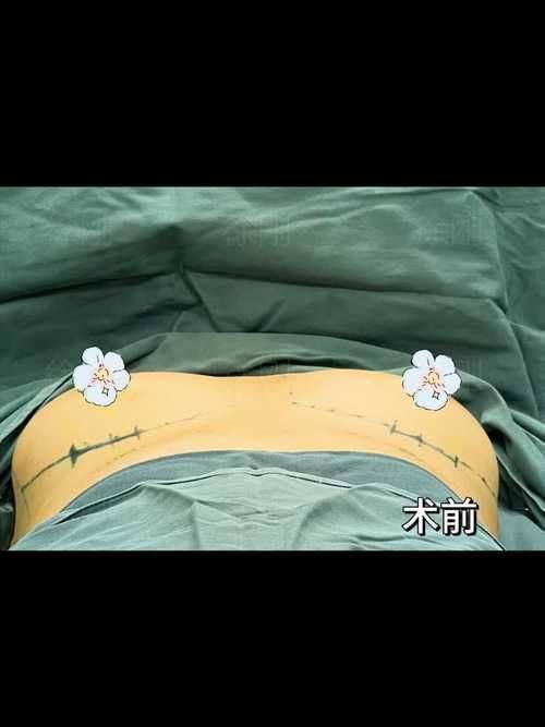 广州南方医 科 大学南方医院整形美容外科医生团队实力强大及骨干医生简介