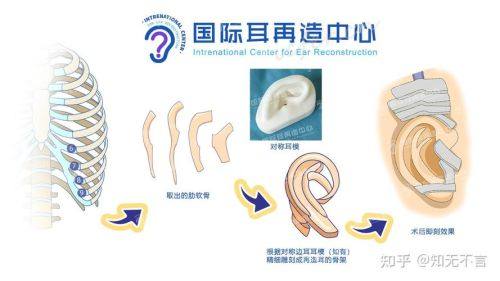 福州恩喜医疗美容门诊部特色项目及技术优势