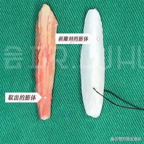 广州南方医 科 大学南方医院整形美容外科收费价格表/收费标准