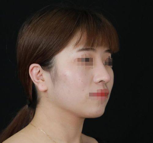 无锡凡千美整形医院特色项目及技术优势