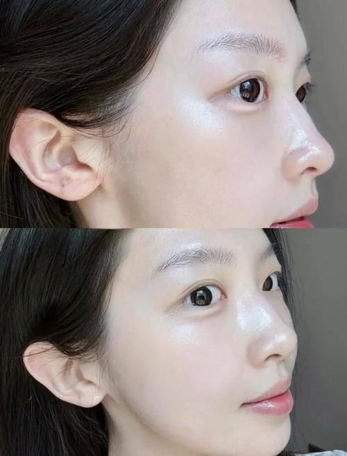 佛山南海观自在整形医院是正规医院吗?