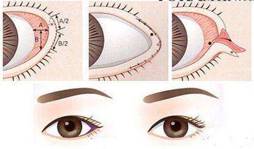 株洲雅美医疗美容门诊部收费价格表/收费标准