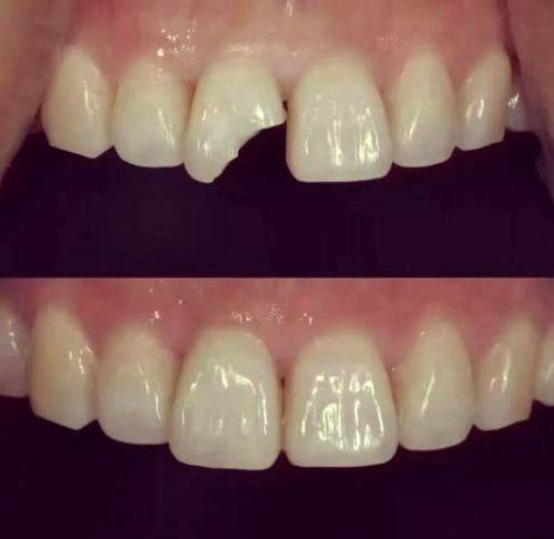 海南海口嘉宇口腔是正规医院吗？