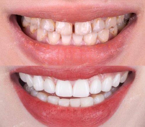 西安交大口腔医院是正规医院吗?