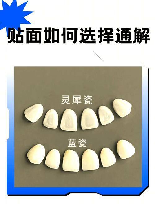 曲靖贝安口腔门诊部是正规医院吗?