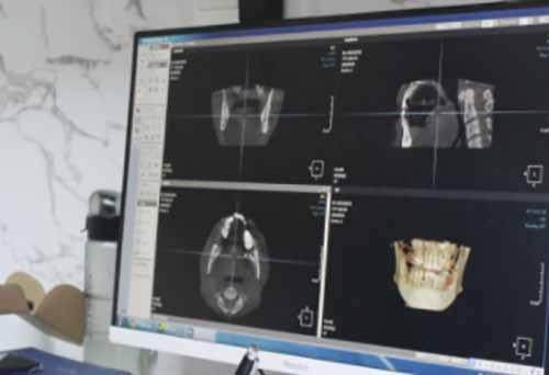 济宁任城壹颗芽口腔门诊部特色项目及技术优势