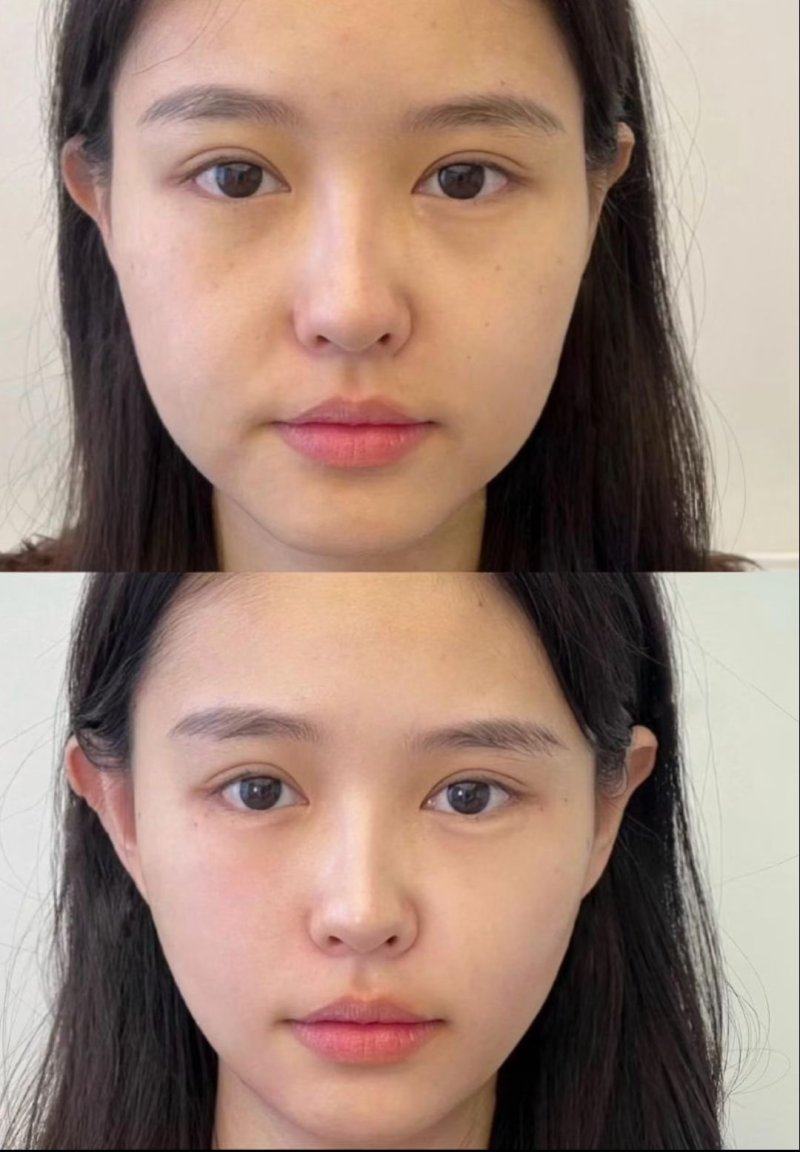 柳州檀悦双美医疗美容诊所收费价格表/收费标准