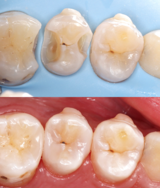 三亚爱雅仕口腔门诊部真人口碑评价怎么样？