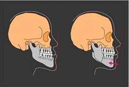 韩相百院长擅长项目