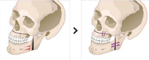韩相百医生价格表