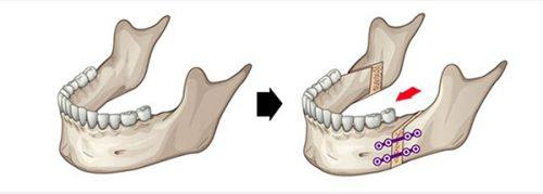 尹泰镐医生预约挂号