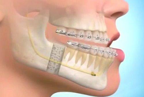 韩相百医生技术优势