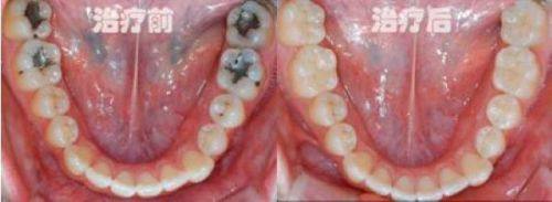 陶胤彤医生坐诊医院