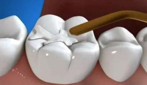 深圳正夫口腔（海内外之窗店）收费价格表/收费标准